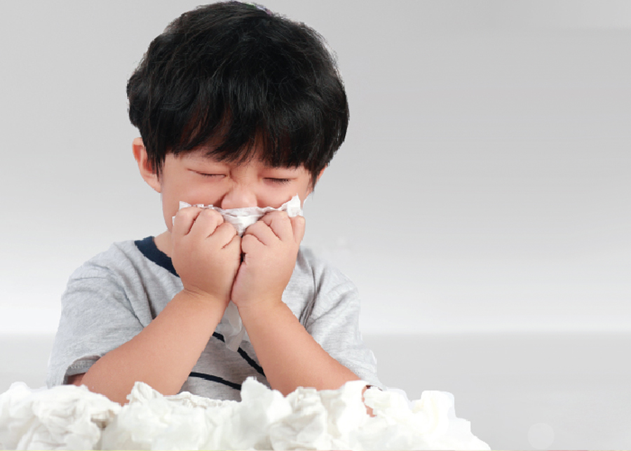 Viêm mũi xoang xuất tiết là tình trạng tăng tiết dịch nhầy bất thường ở mũi và xoang.